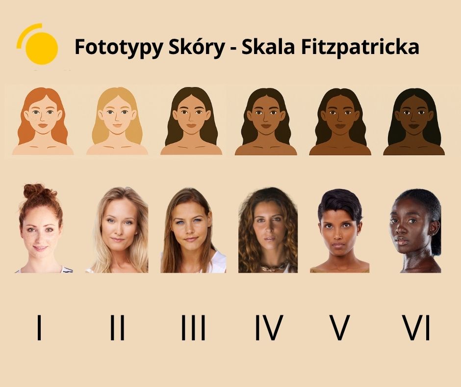 Fitzpatrick skin types for solarium